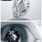 ieee-spectrum-bionic-eye
